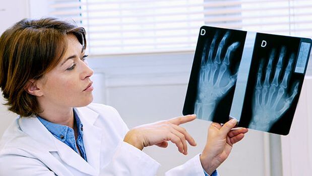 Consulta Reumatología